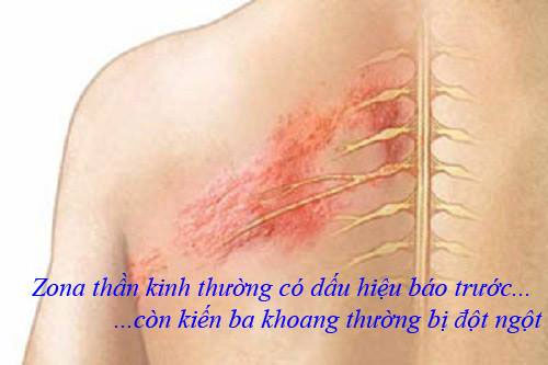Các tổn thương do kiến ba khoang gây ra thường xuất hiện nhanh chóng