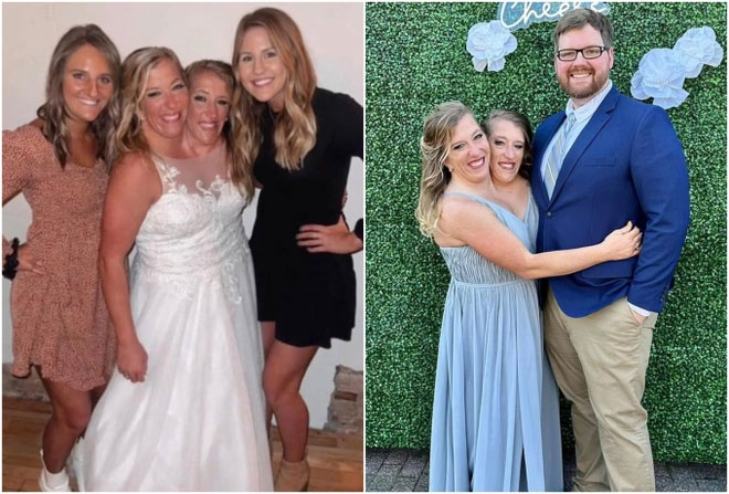 abigail-andd-brittany-hensal Abby gây bất ngờ khi đăng tải hình ảnh trong lễ cưới của mình với chồng vào năm 2021.