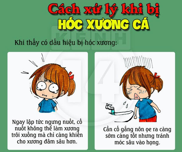 Giải pháp xử lý ngay khi bị hóc xương cá