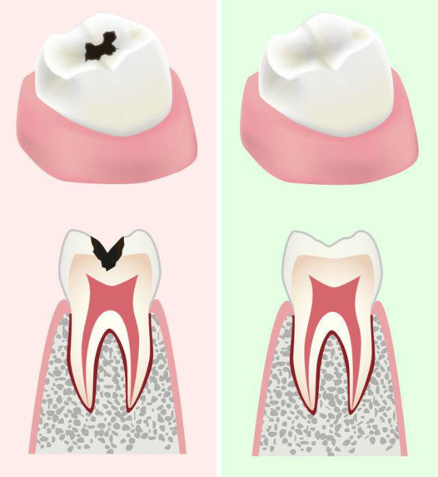 loi-ich-khi-an-dua-chuot-moi-ngày-11 Cải thiện sức khỏe răng miệng