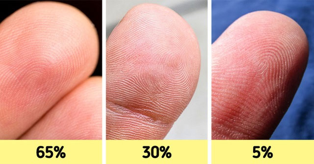 Khám Phá 12 Đặc Điểm Cơ Thể Hiếm Gặp Nhiều Người Không Có