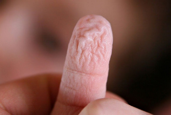 ngontaynhannheo Ngón tay sẽ nhăn lại khi bị ngâm lâu trong nước.